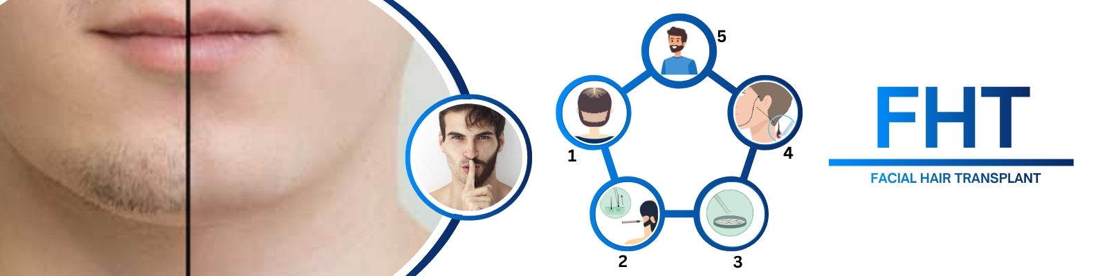Facial Hair Transplant Doctors in Hyderabad