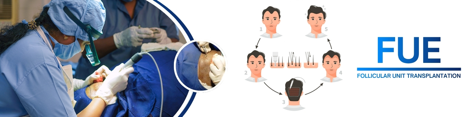 FUE Hair Transplant Doctors in hyderabad
