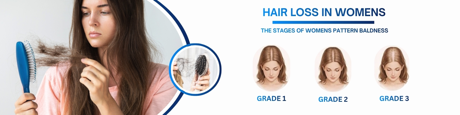 hair loss treatment Doctors in hyderabad